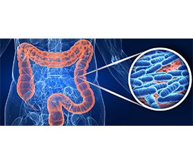 Hubungan Mikrobiota Usus dengan Keseimbangan Proses Metabolik